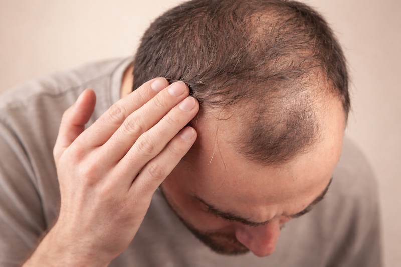 Man with thinning hair touching his head against a beige background