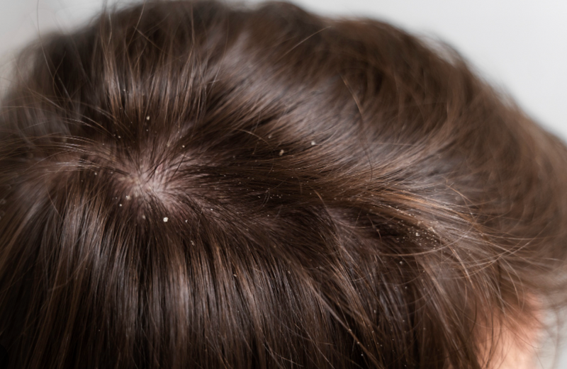 Close-up of a person's head with dark hair on a plain background